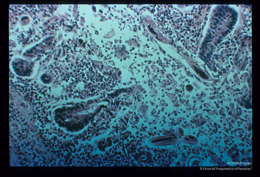 Same case. Portion of adult.