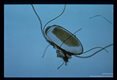 A louse egg (nit) attached to hair.