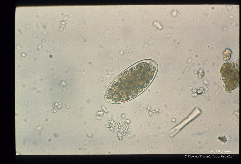 Egg from human stool. Characteristically this egg is longer than hookworm eggs.