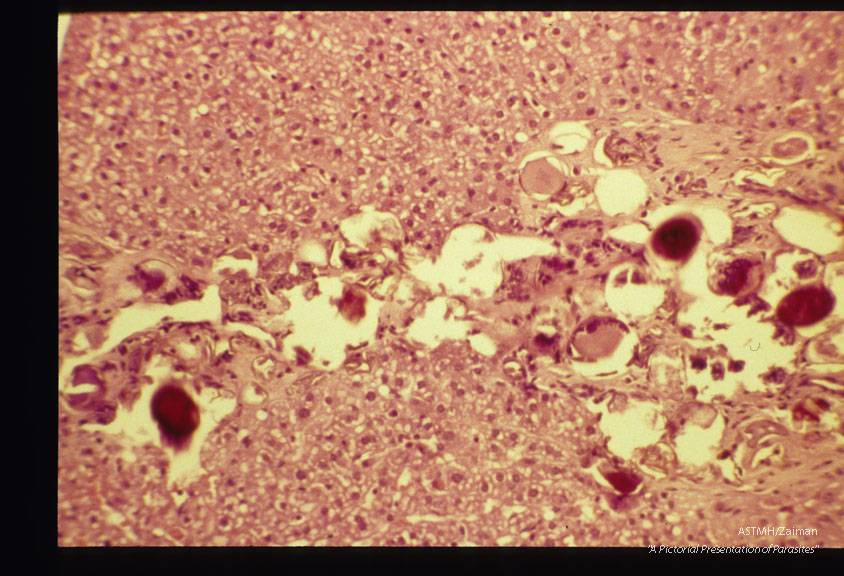 Eggs in armadillo (Dasypus novemcinctus) liver.