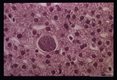 Exoerythrocytic stage in the liver of an experimentally infected monkey.