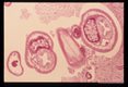 Dog cecum. Cross sections through the thin 