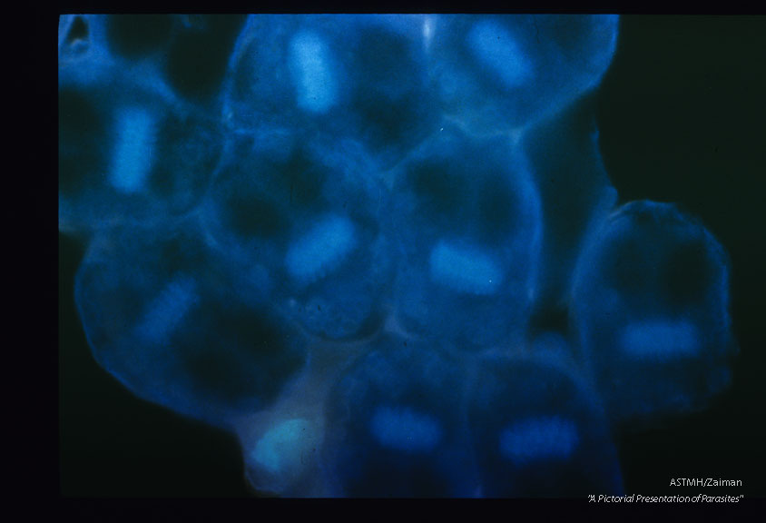 Scolices illuminated with ultra violet light.