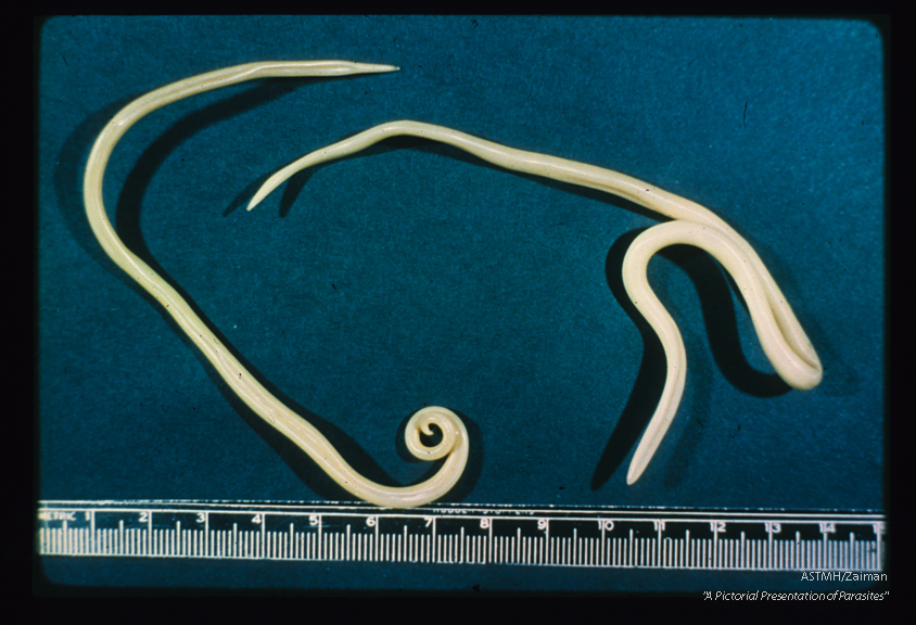 An adult male (coiled posterior end) is shown with a female. The anterior end is more slender than the posterior.