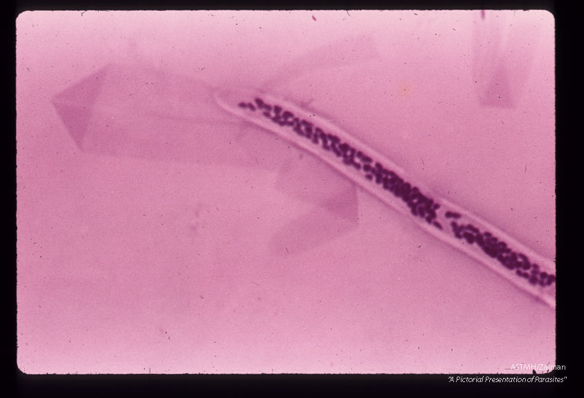 Anterior end of same microfilaria.