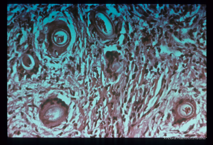Cross section of adults in bowel.