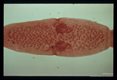 Gravid proglottid again showing the double set of genital organs. The masses within the proglottids are groups of eggs.