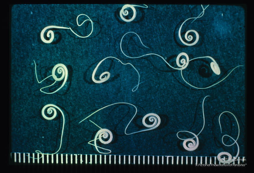 Several adult males are shown. Note the coiled posterior ends and the thin anterior regions.