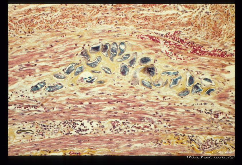 Multiple sections through appendix.