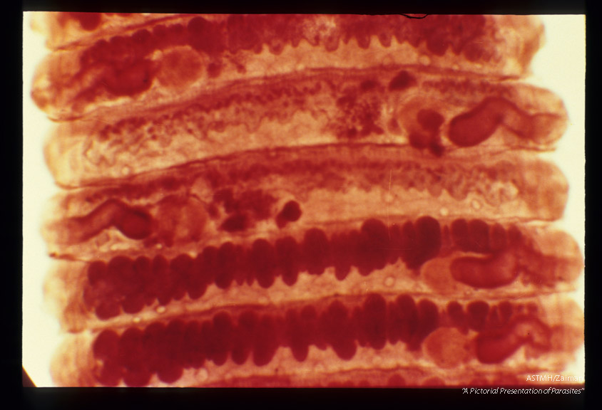 Segments from human case.
