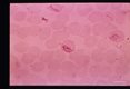 Growing trophozoites.