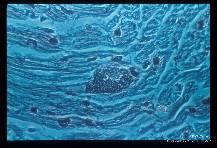 Hematoxylin-eosin stained (phase microscopy) section of infected myocardium.