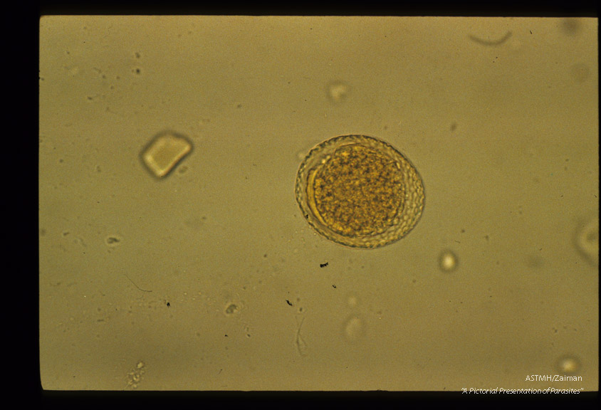 Egg.