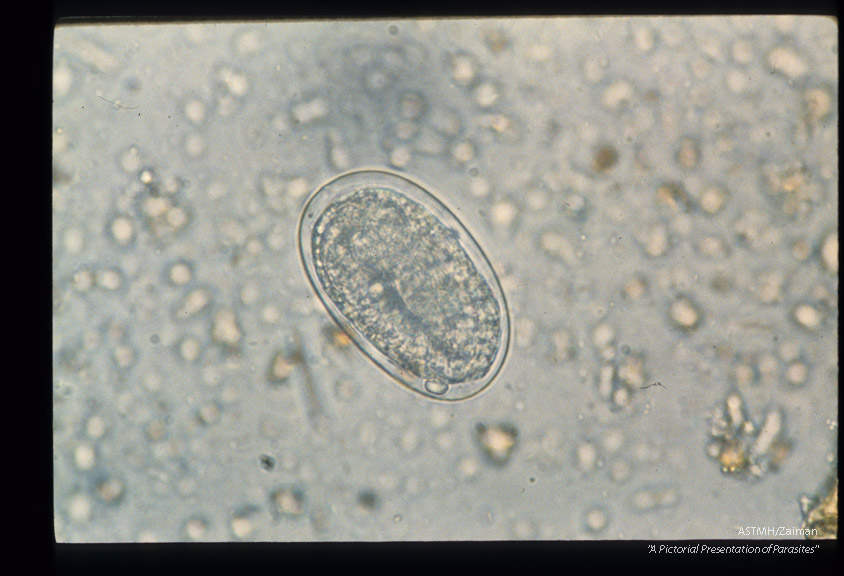 Sequence showing development of larva in egg.