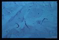 Sporozoites from mosquito.