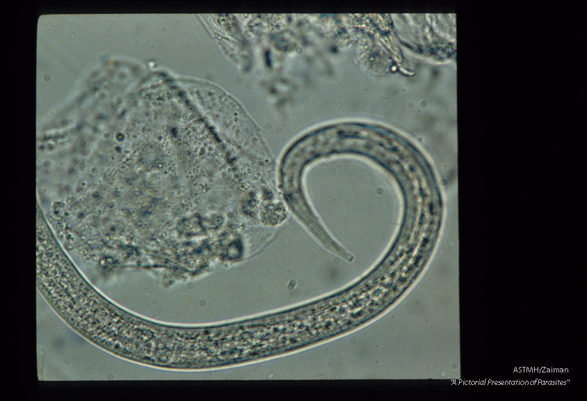 Filariform larva with forked tail.