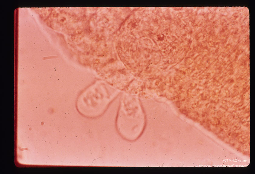 Miracidium has just penetrated the snail host leaving behind the two epidermal plates of the last row.