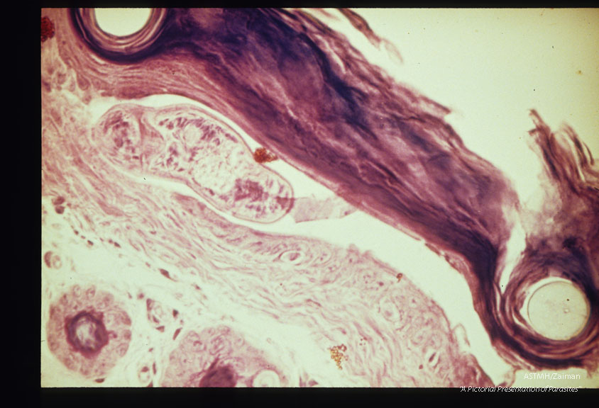 Cercariae before and after skin penetration. These slides compliment slides 1258 through 1262.