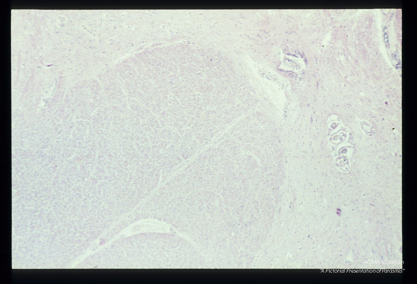 Longitudinal and cross-section of larvae in the spinal cord.