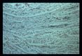 Parts of two very young larvae are seen invading muscle.