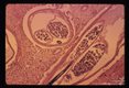 At higher power, the microfilariae are readily identified. The gut is seen as a cross section in the lower parasite and longitudinally in the upper parasite.
