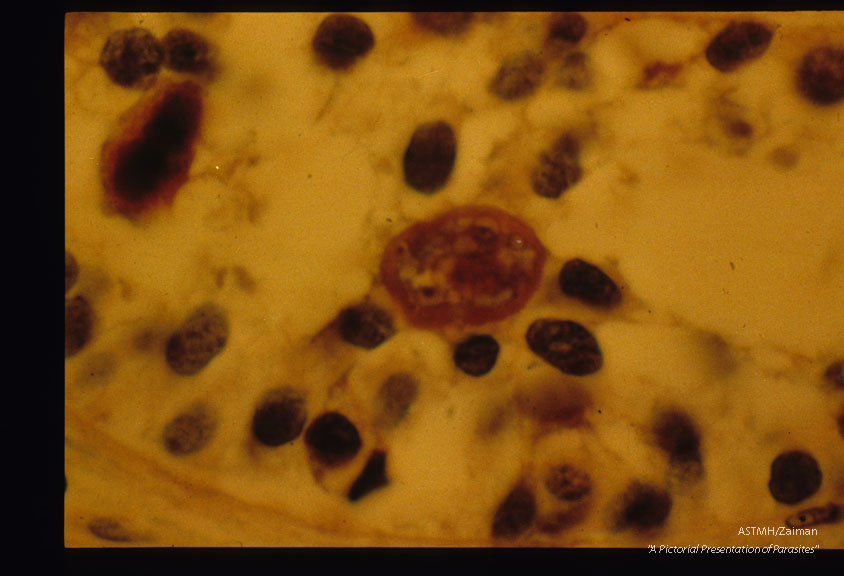Migrating larva is present in a seminiferous tubule.