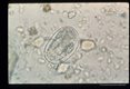 Sequence showing development of larva in egg.