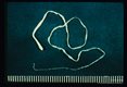 Plerocercoid from experimental rat infection. The anterior portion is thicker than the posterior. Relatively little detail can be seen in this slide. Compare with slides number 4 and 5.