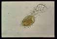Trophozoite showing cilia and contractile vacuole.
