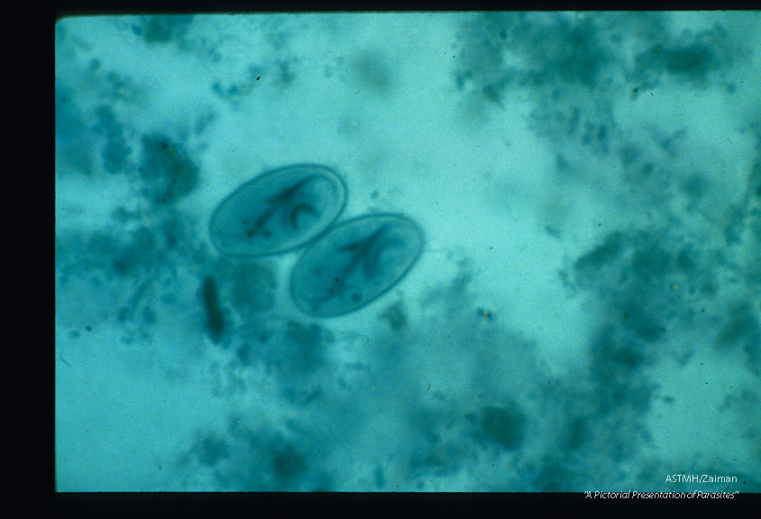 Cyst in stool. Haemotoxylin stain.