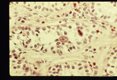 Migrating larva is present in a seminiferous tubule.