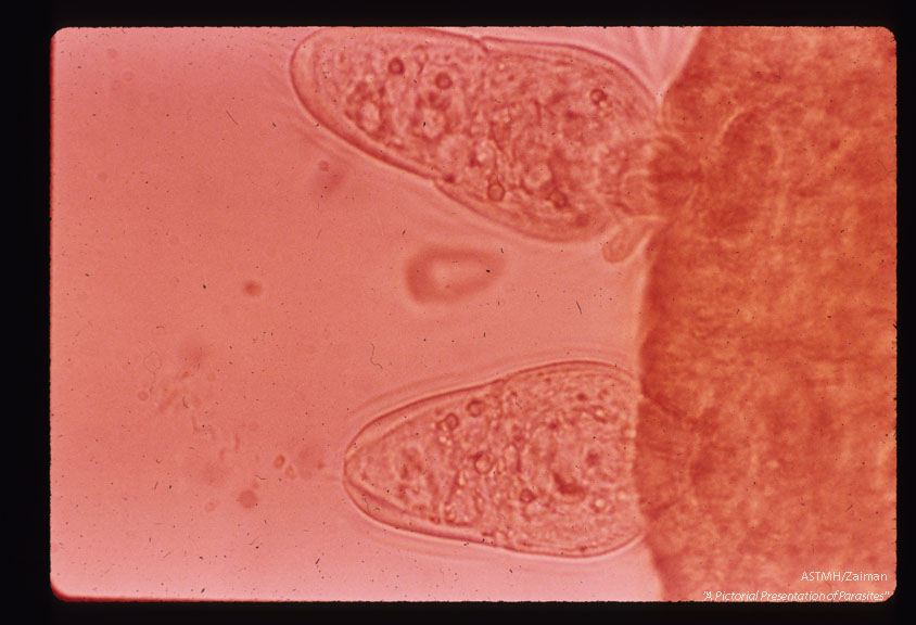 Two miracidia penetrating the snail host. Second row of epidermal plates being shed by one of the miracidia.