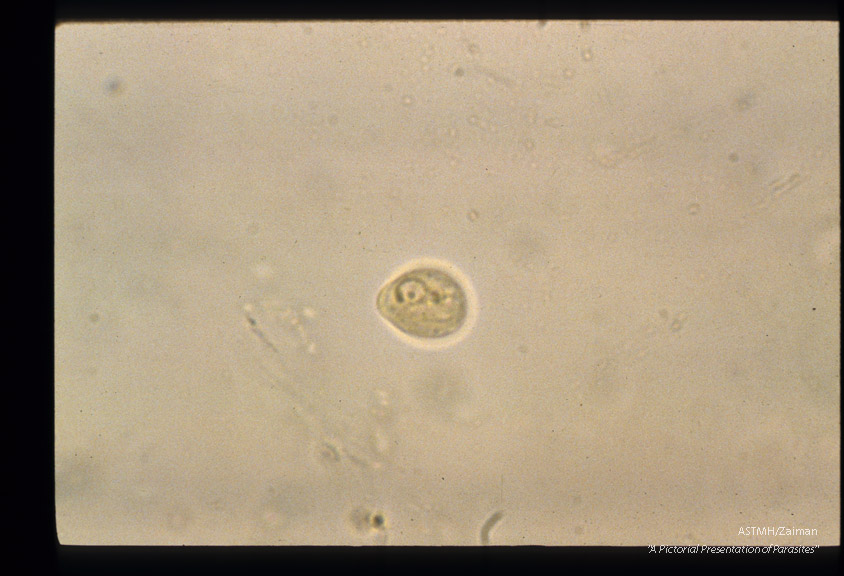 Uninucleate lemon shaped cyst, iodine stained.