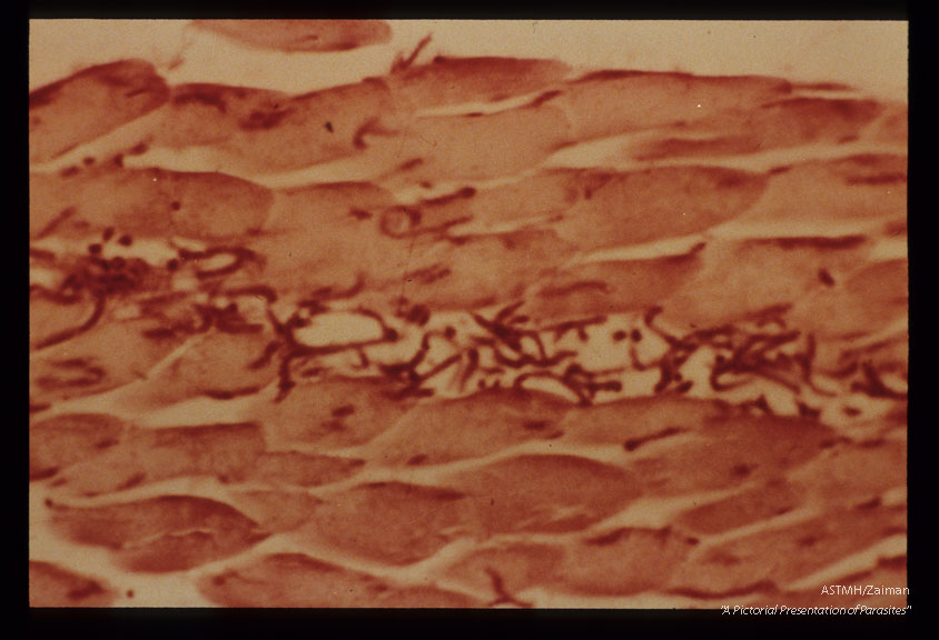 H & E stained section of muscle injected 10 minutes earlier with newborn larvae.