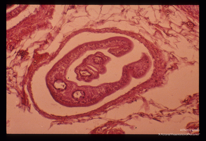Paired adult male and female in a mesenteric vein. One of the pairs is seen at greater magnification.