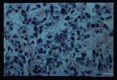 Human lung. Giemsa stain .