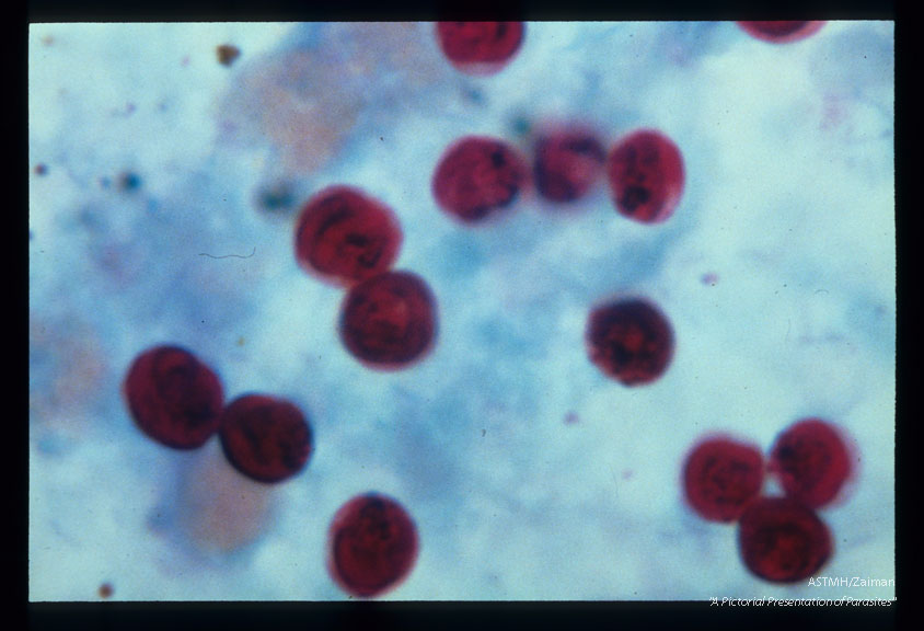 Stool specimens stained by hot acid fast technique.