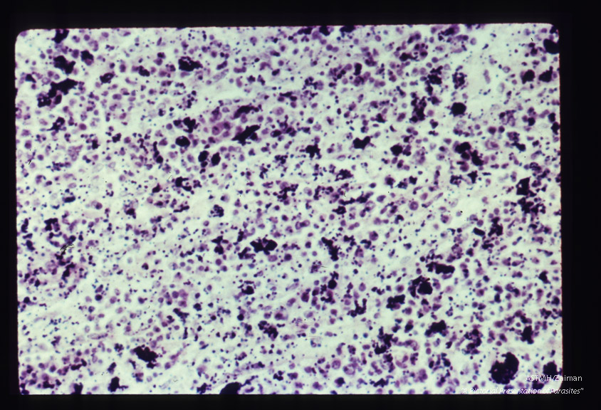 Pigment in human spleen.