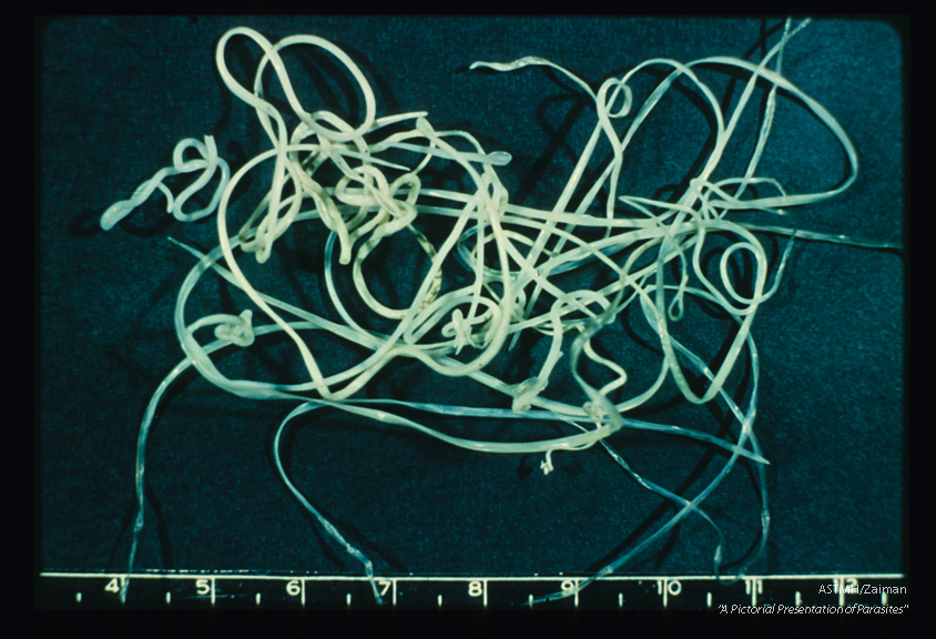 A group of plerocercoid larvae are shown.