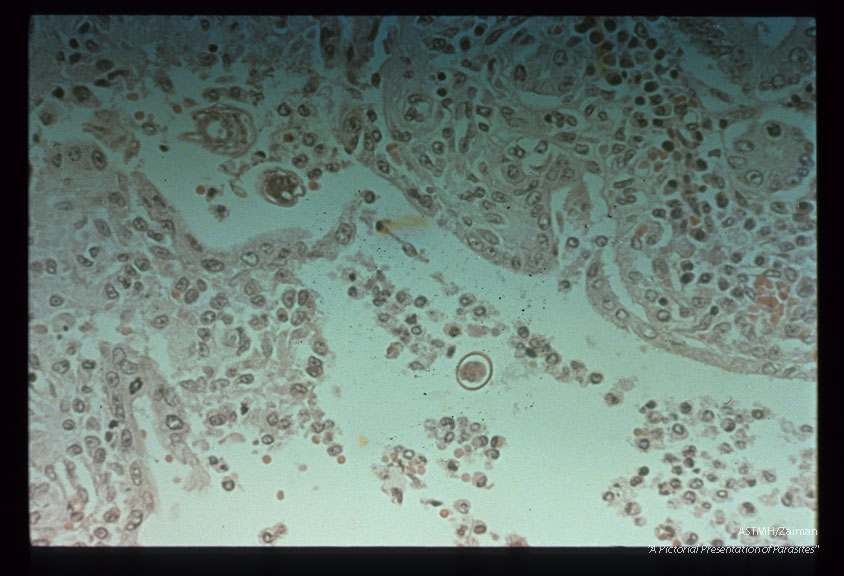 Cross section of adults.