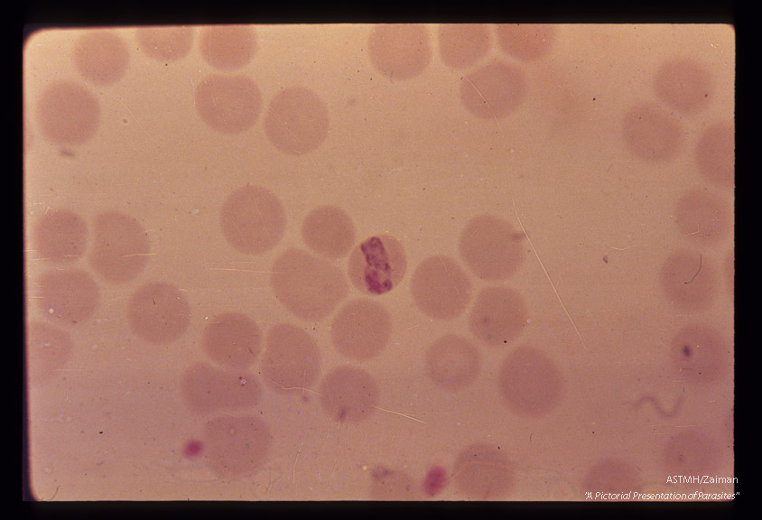 Band form in erythrocyte.
