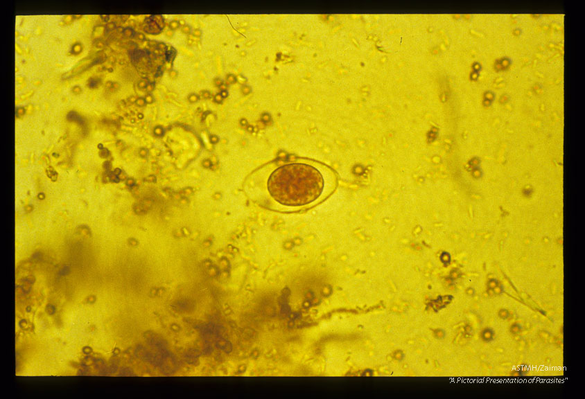 Oocysts, iodine stained and unstained in stool